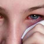Conjuntivitis: cuidados prudentes y cuándo consultar