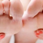 Aliviar el Dolor de Juanetes